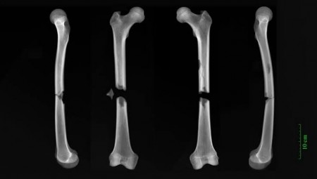 عدم المساواة بإنجلترا تظهر في عظام سكان العصور الوسطى بإنجلترا