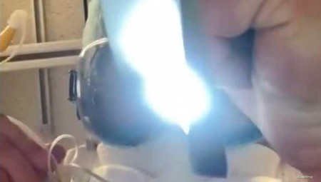 طبيب يتوسل بفيديو.. ارتدوا الكمامات