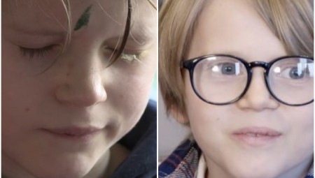 أب بريطاني يخطئ في العبوة العلاجية ويضع في عيني طفله الغراء اللاصق
