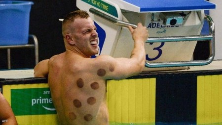 الحجامة تثير الانتباه في أولمبياد طوكيو