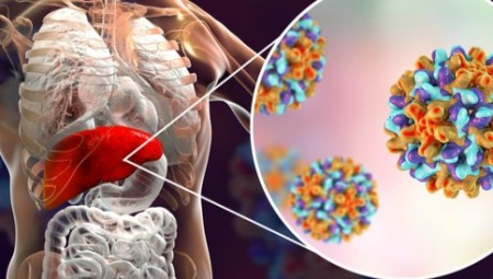 بعد بريطانيا .. إصابات مجهولة المصدر بالتهاب الكبد لدى أطفال في بلدان أوروبية