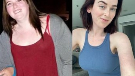 فتاة تنفق مدخرات أبيها البالغة  30 ألف إسترليني للحصول على جسد نحيل