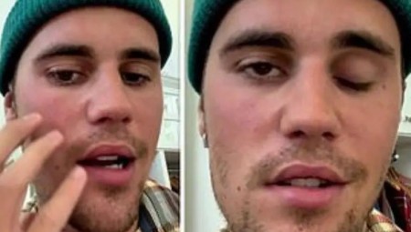 النجم الأميركي جاستن بابر يكشف عن إصابته بشلل جزئي