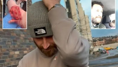 مالك كلب XL Bully يتنصل من محاولة السيطرة عليه أثناء مهاجمته فتاة