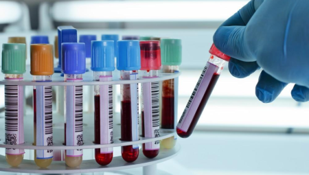 (NHS) تطلق اختبار دم ثوري للكشف عن سرطان الرئة